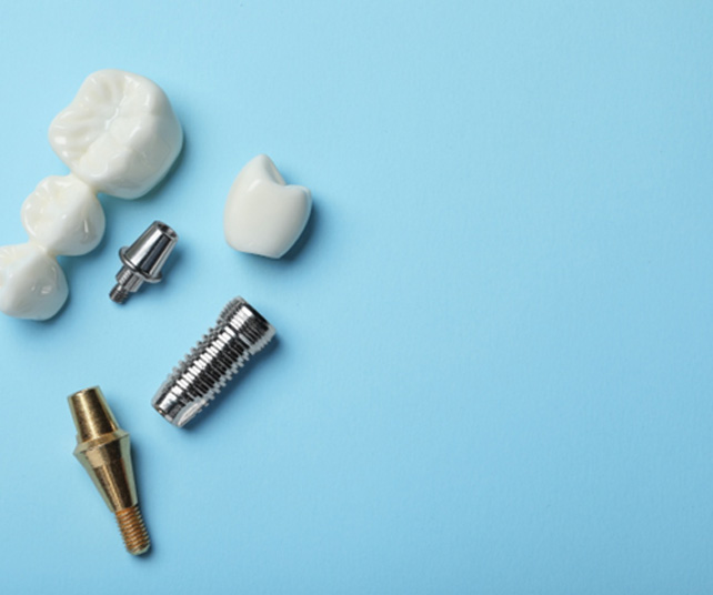 Dental implants are permanent tooth replacements