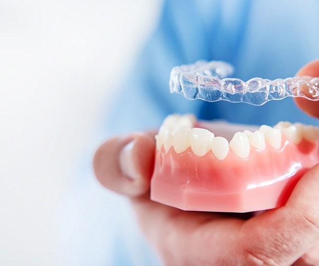 Dentist placing clear aligner on model of teeth
